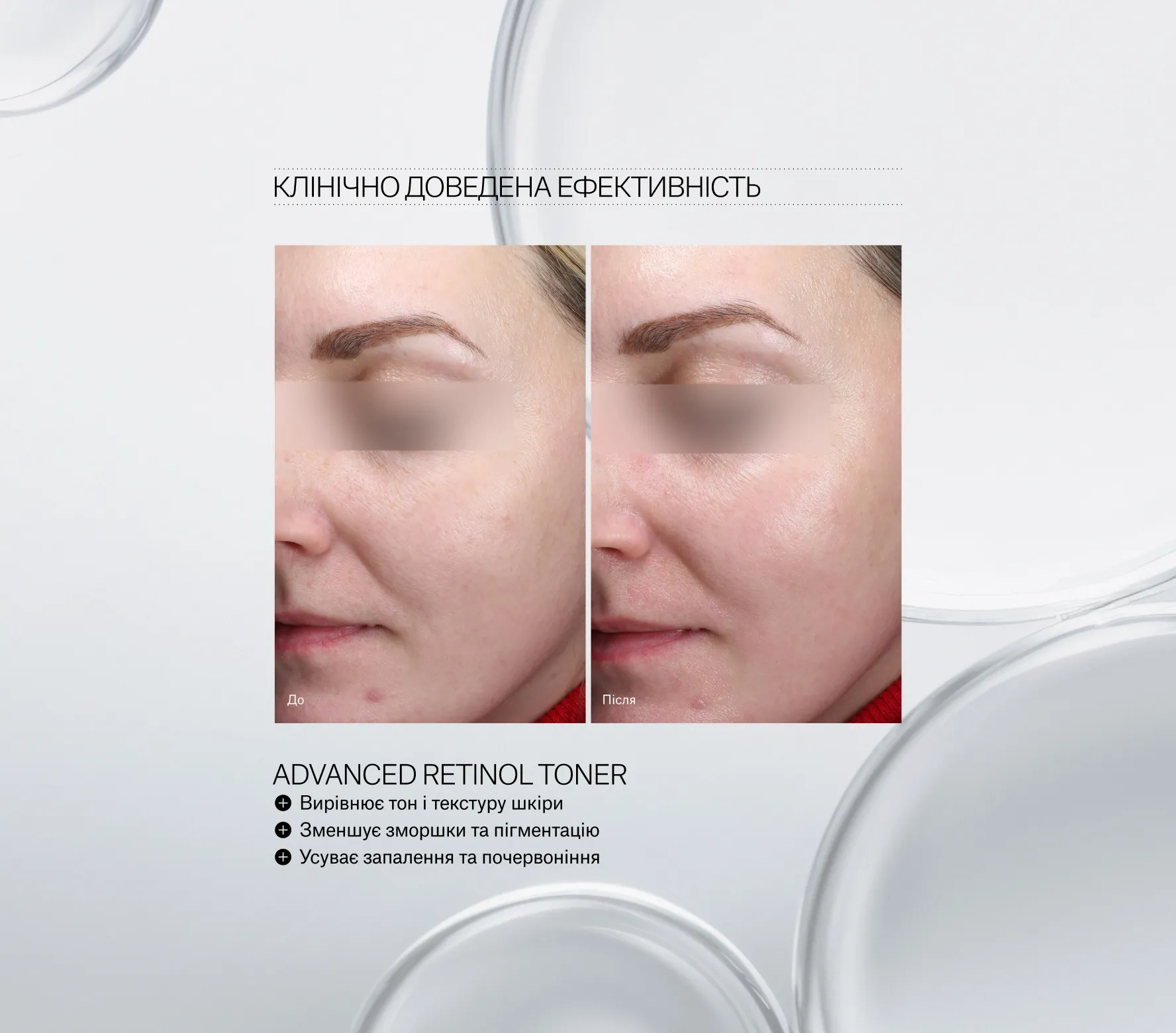 Before and after close-up of a woman's cheek showing improved skin texture after using Advanced Retinol Toner.