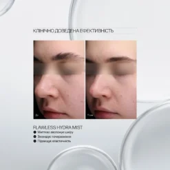 Two side-by-side close-ups of a woman's face labeled 'До' (Before) and 'Після' (After) showing skin improvements after Flawless Hydra Mist.
