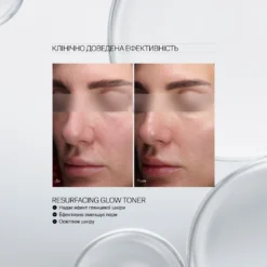 Before/after close-up of a woman's face showing skin improvements from a resurfacing toner; Ukrainian headline above reads 'Клінічно доведена ефективність'