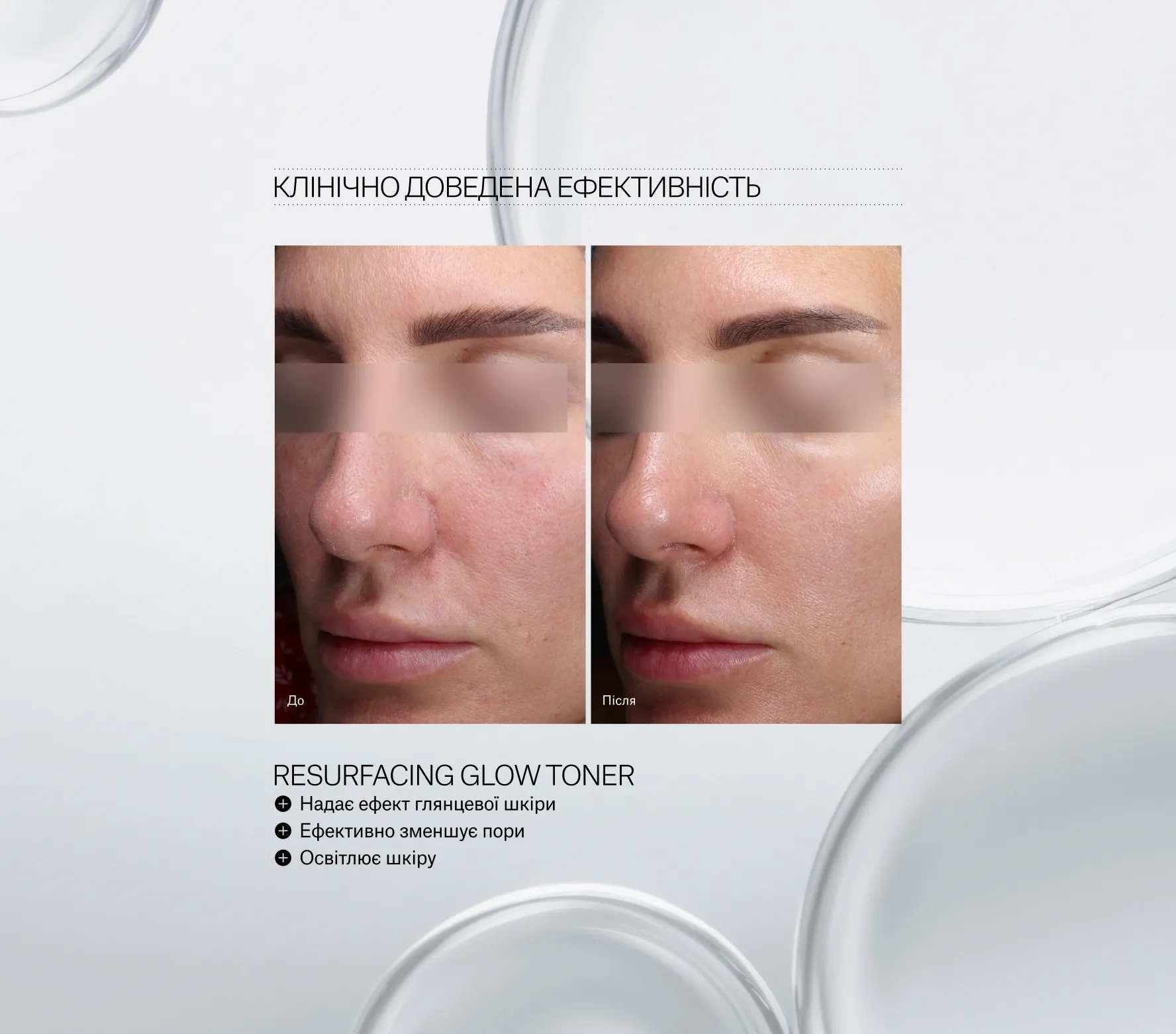 Before/after close-up of a woman's face showing skin improvements from a resurfacing toner; Ukrainian headline above reads 'Клінічно доведена ефективність'
